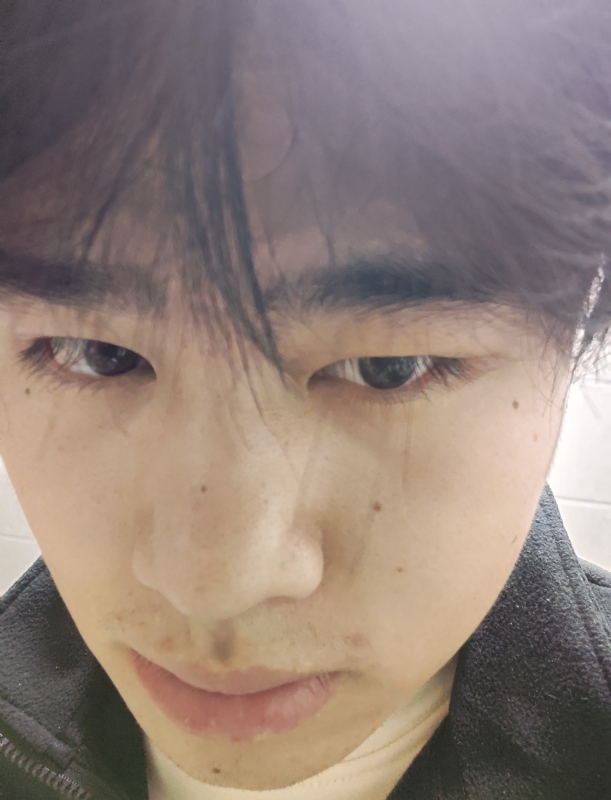 伤男的第一张照片--河南残疾人相亲网